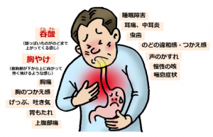 逆流性食道炎（胃食道逆流症）の症状